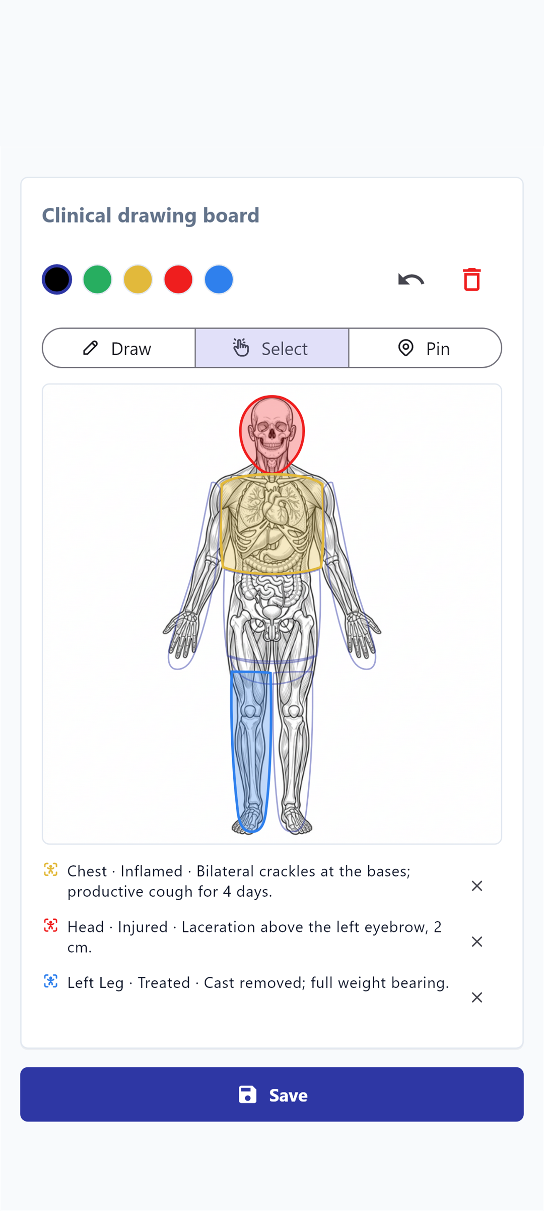 لوحة الرسم السريري في تطبيق Clinova — مناطق الجسم بملاحظات ملوّنة